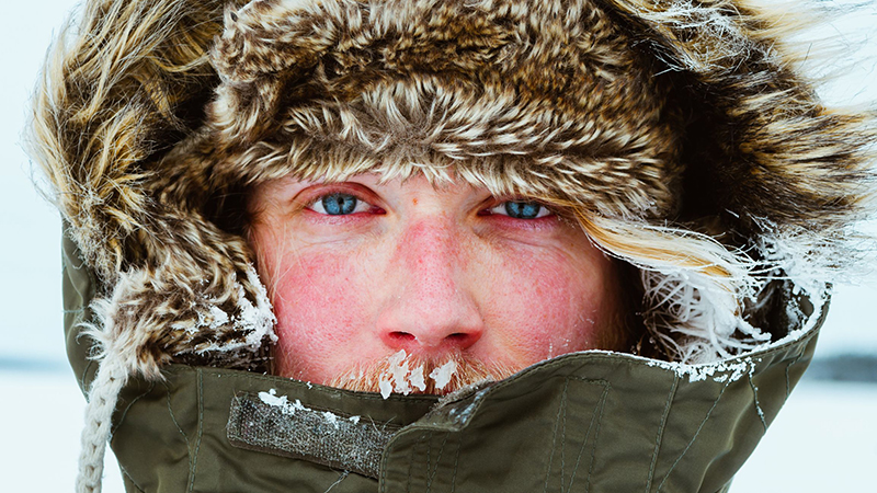 Dị ứng thời tiết lạnh là gì? Nguyên nhân, triệu chứng, cách phòng tránh và điều trị bạn nên biết